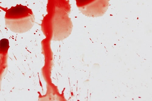 Mơ thấy bị đứt tay - Mơ thấy tay bị đứt chảy máu nhiều Mơ thấy bị đứt tay - Mơ thấy tay bị đứt chảy máu nhiều